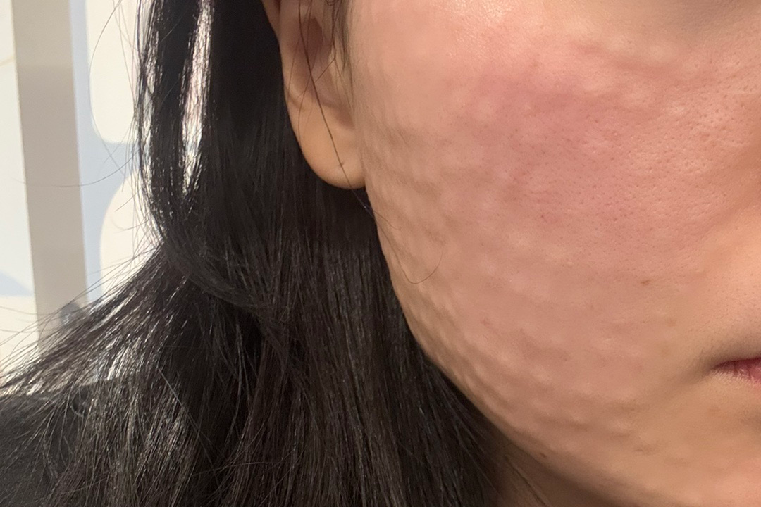 수술후기이미지