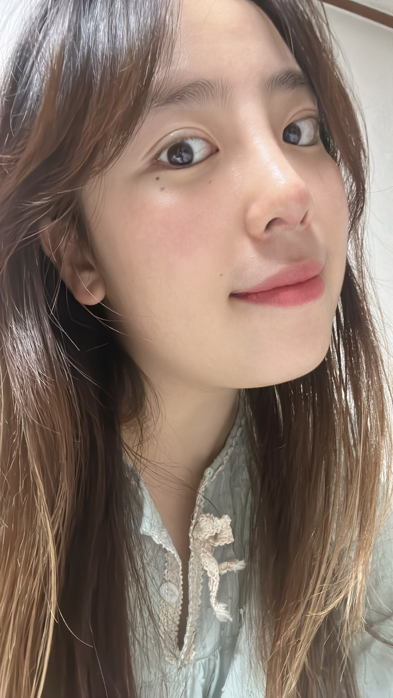 수술후기이미지