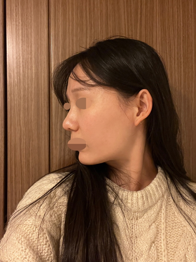 수술후기이미지