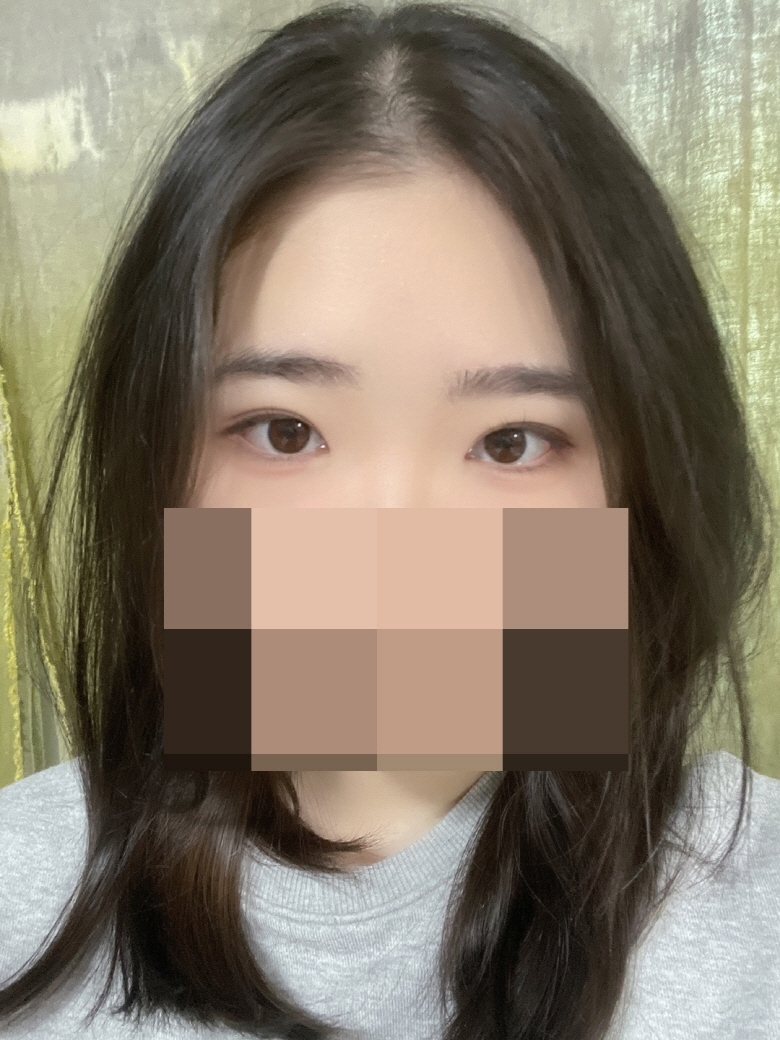 수술후기이미지