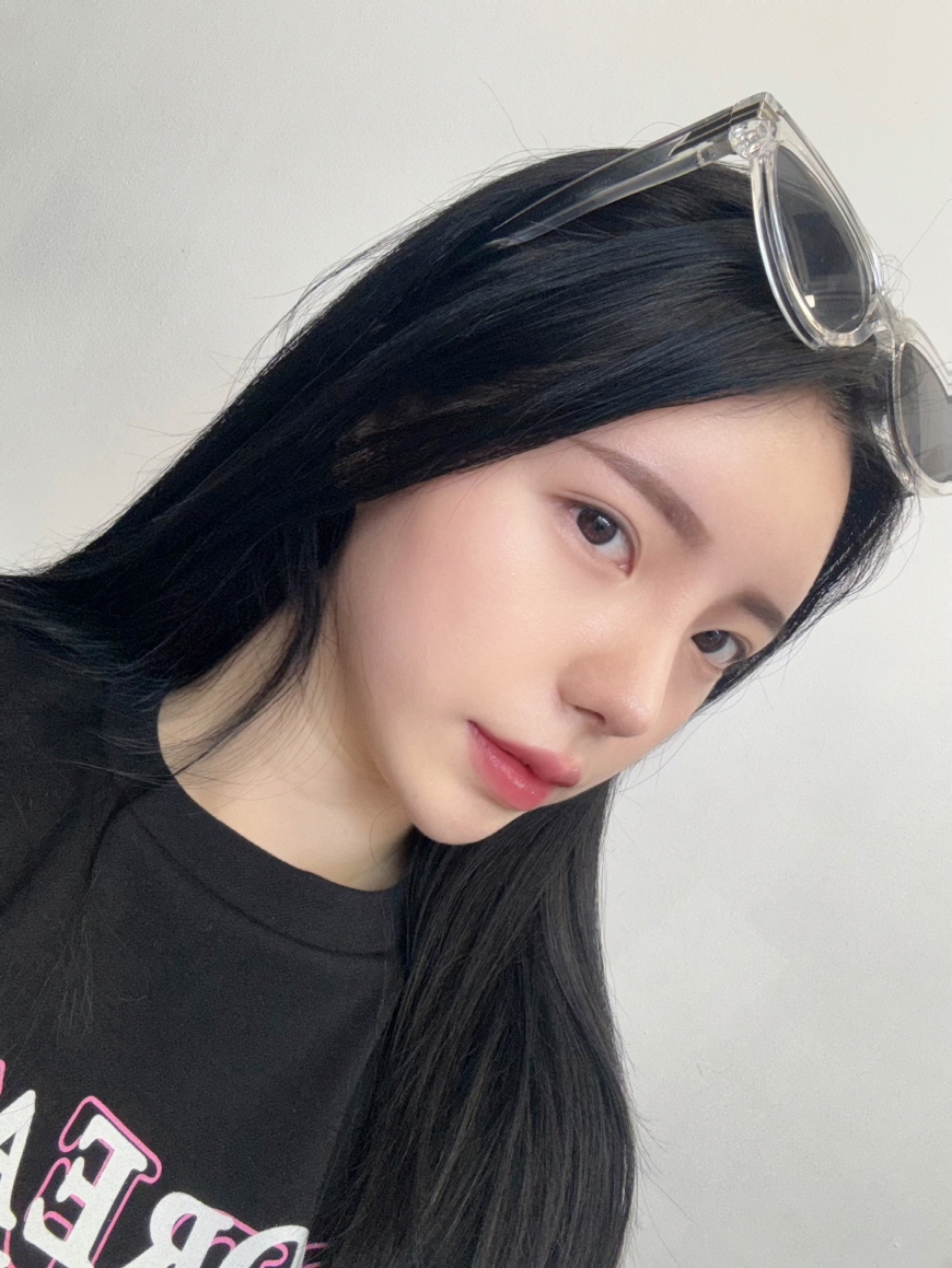 수술후기이미지