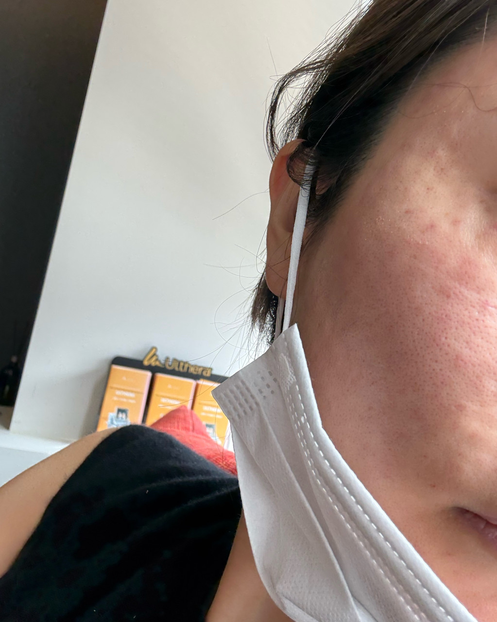 수술후기이미지