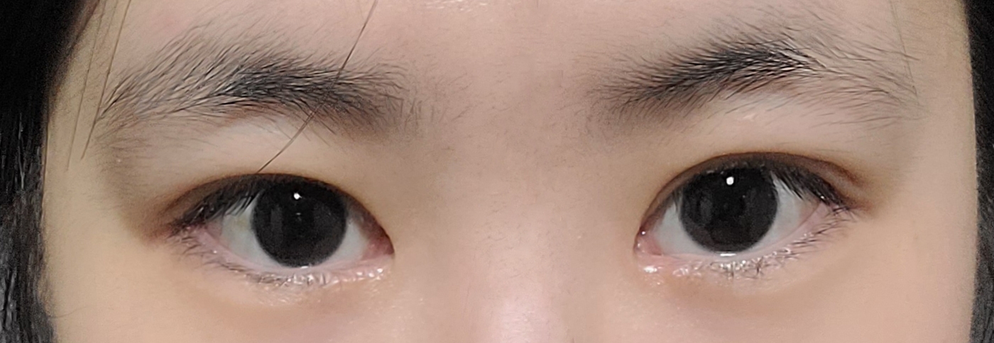 수술후기이미지