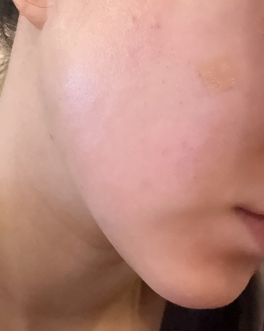 수술후기이미지