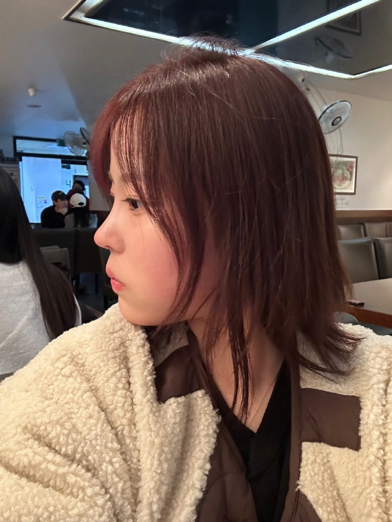 수술후기이미지