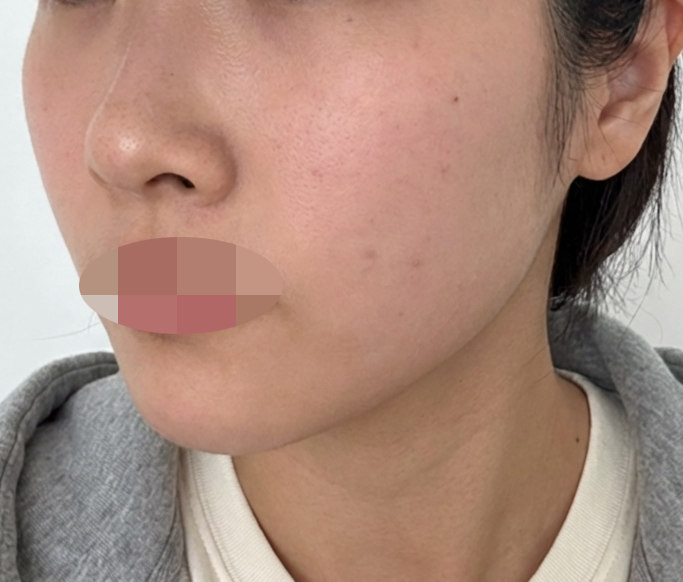 수술후기이미지