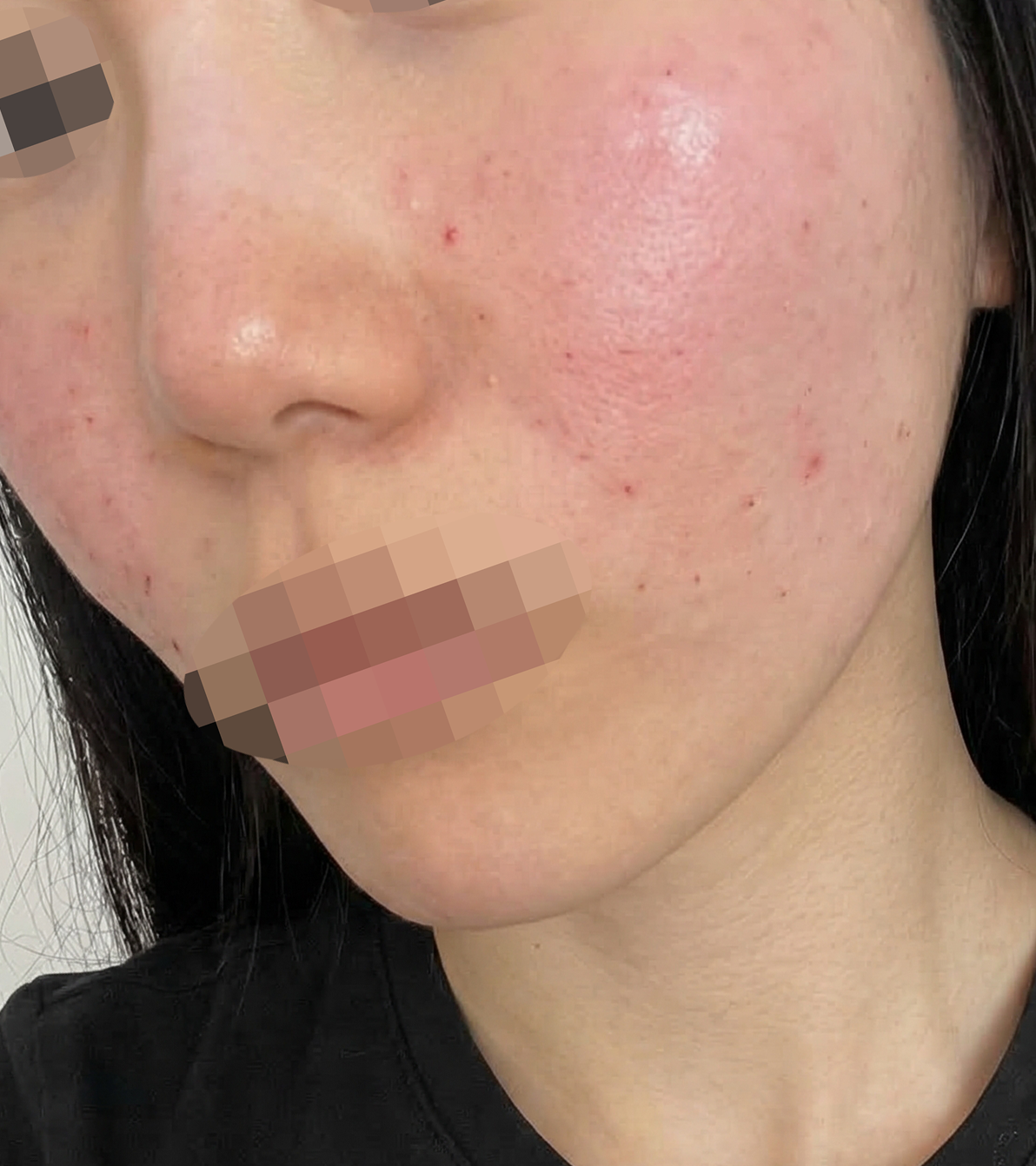 수술후기이미지