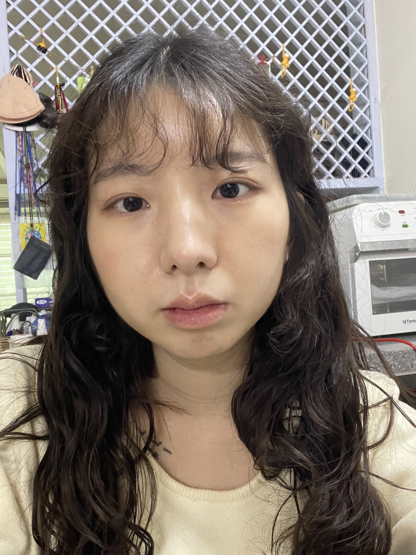 수술후기이미지