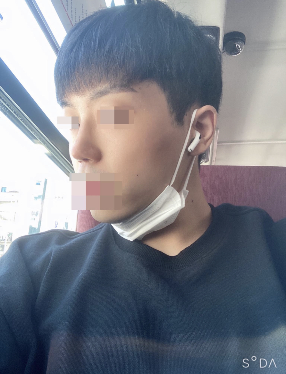 수술후기이미지