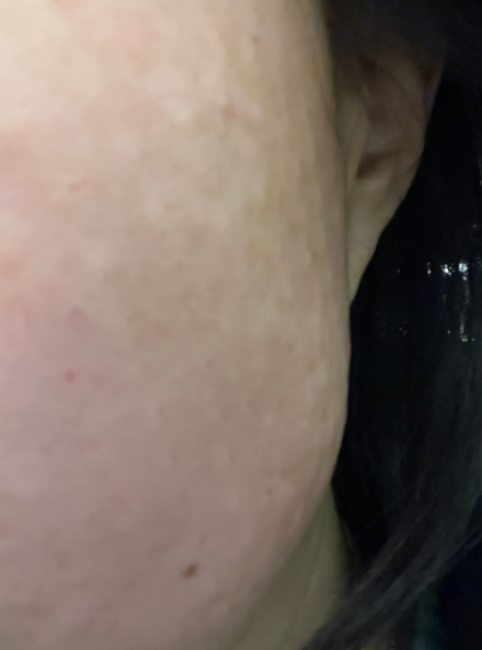 수술후기이미지