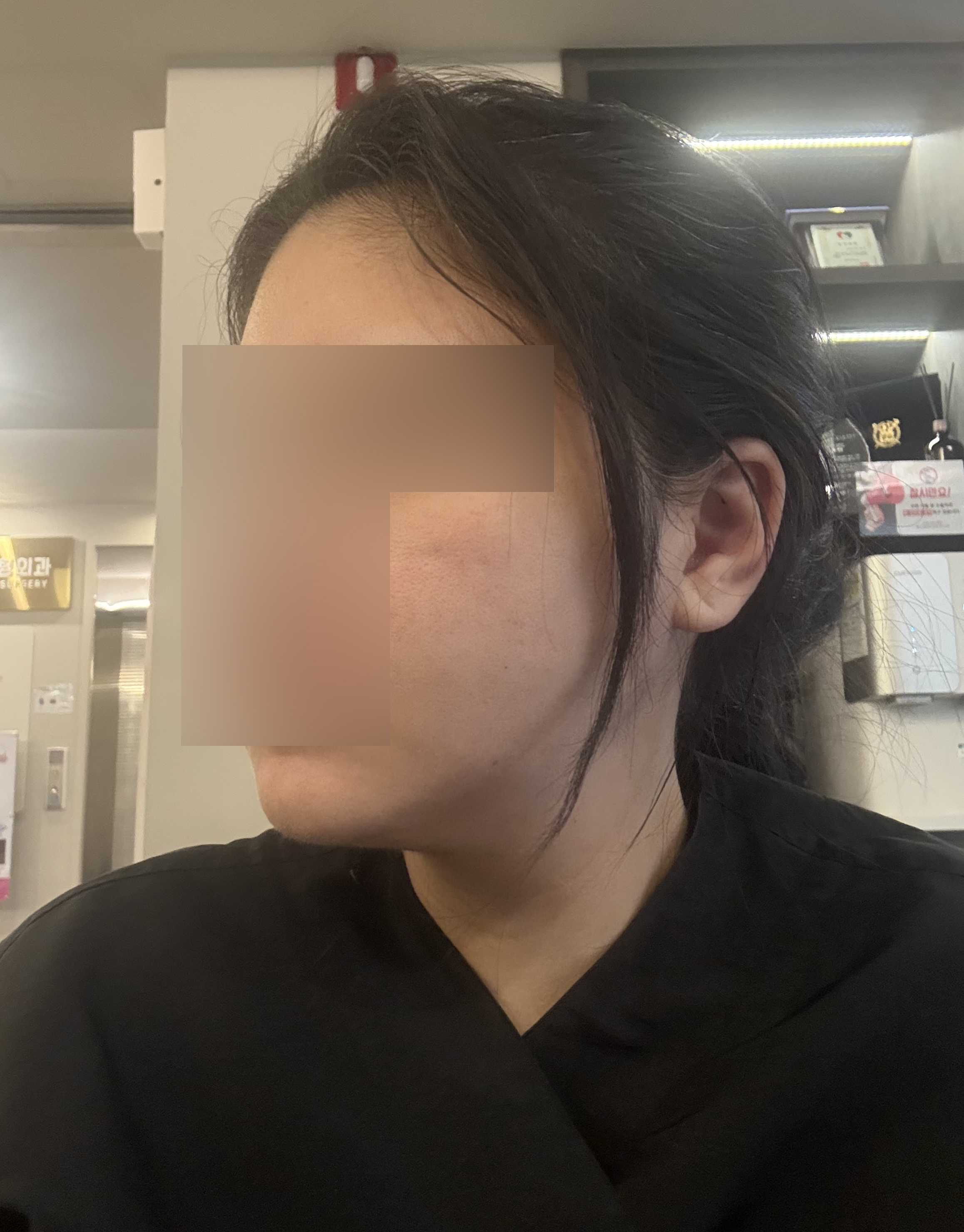 수술후기이미지