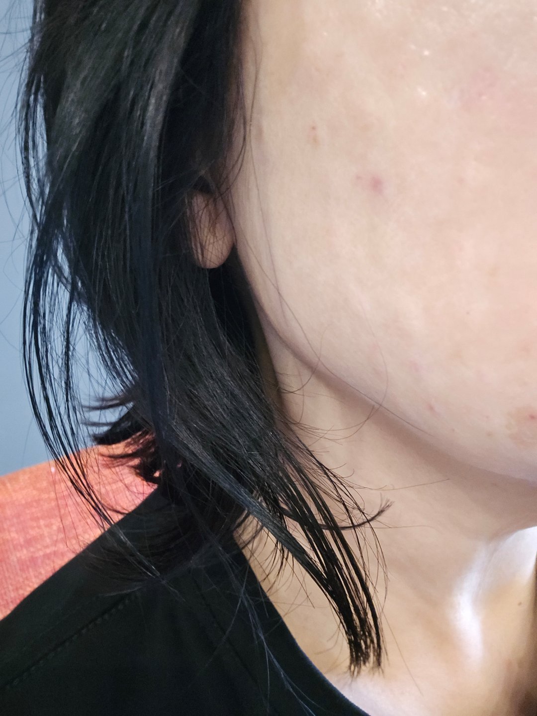 수술후기이미지