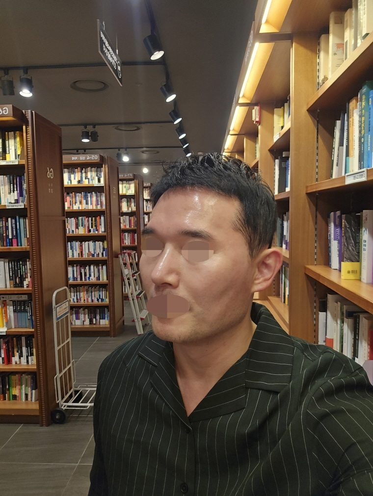 수술후기이미지