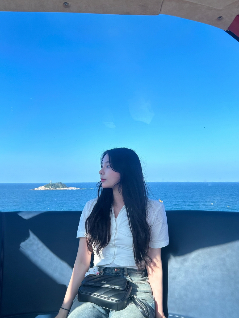 수술후기이미지