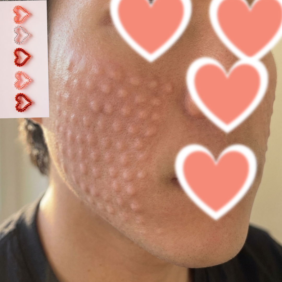 수술후기이미지
