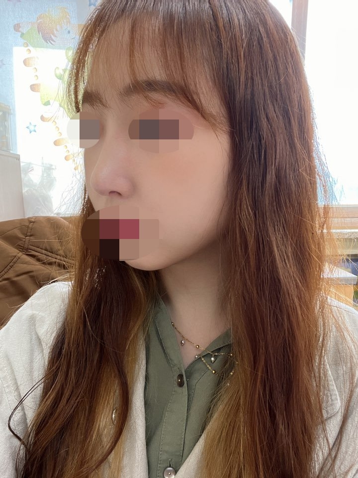 수술후기이미지