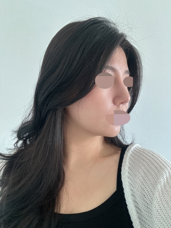 수술후기이미지