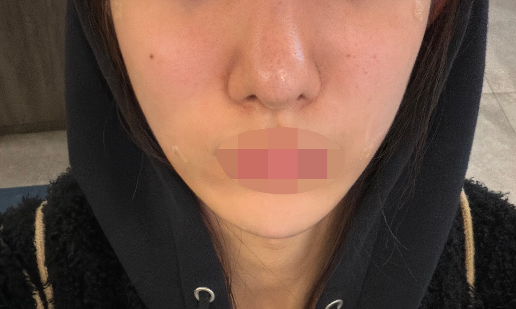 수술후기이미지