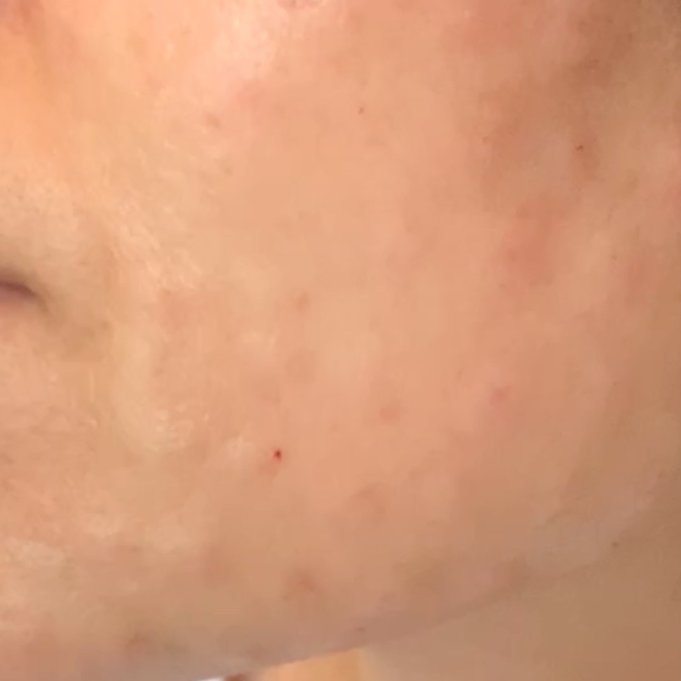 수술후기이미지