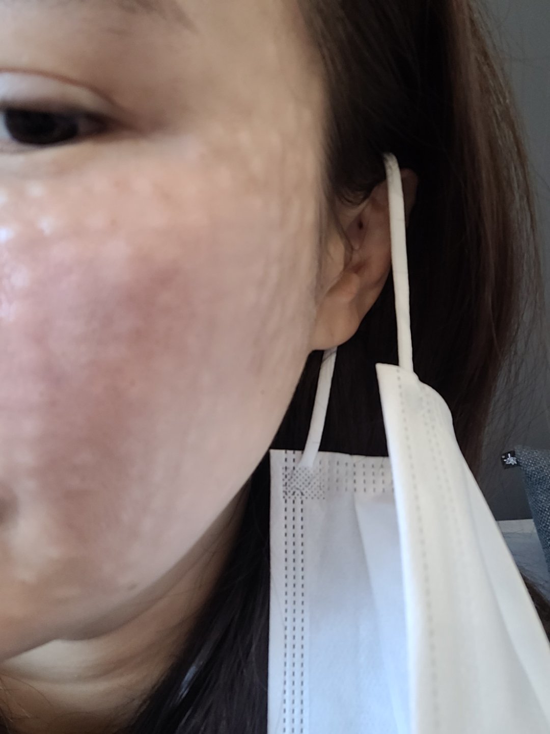 수술후기이미지