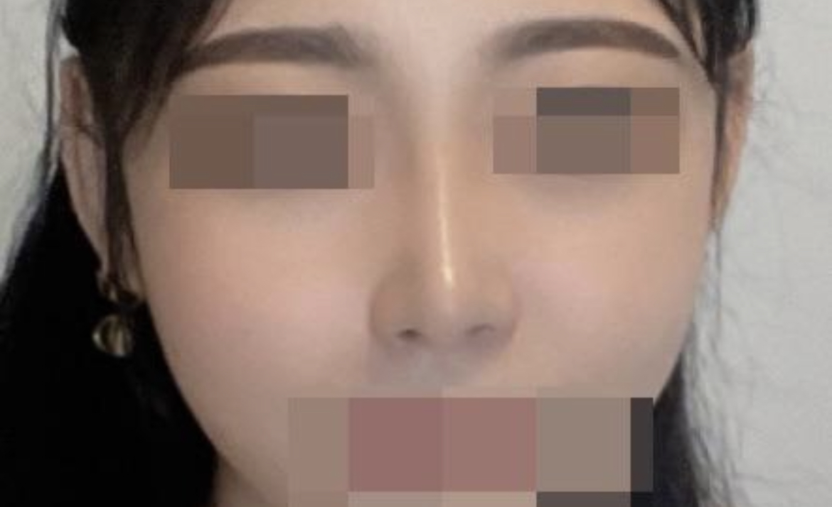 수술후기이미지