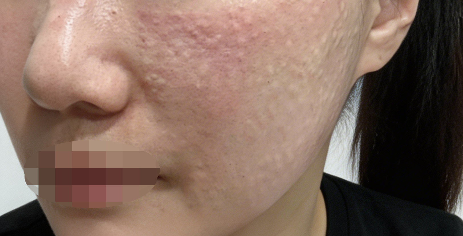 수술후기이미지