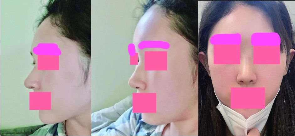 수술후기이미지