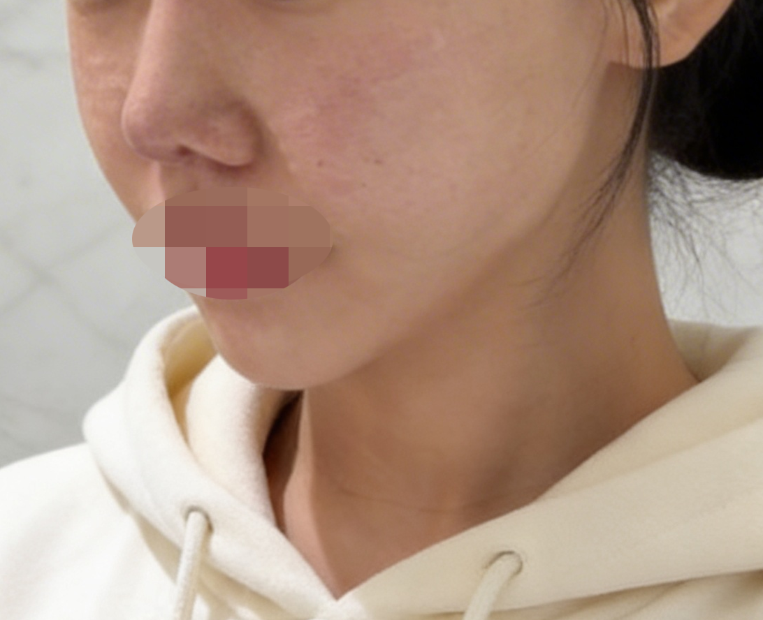 수술후기이미지