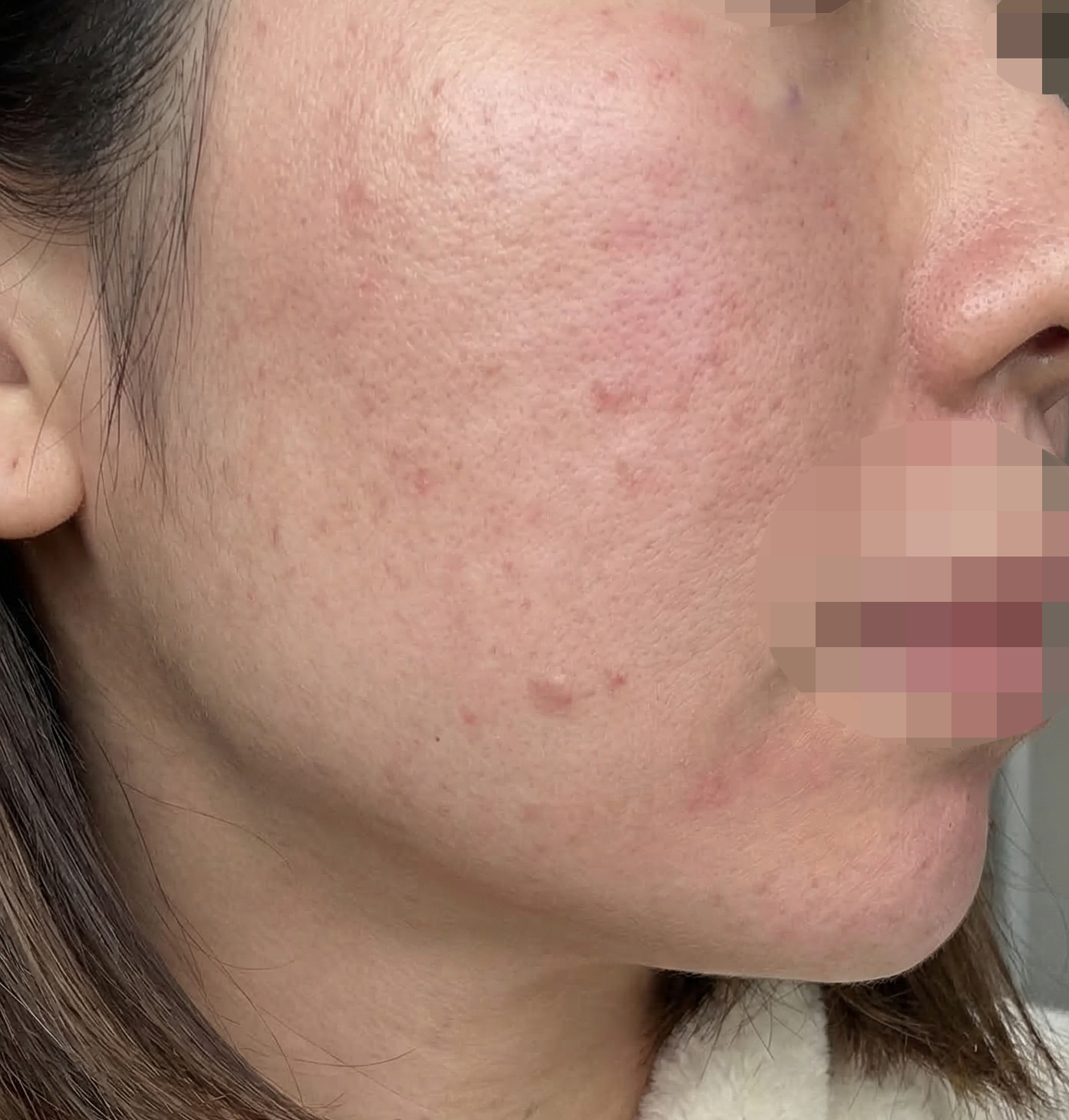 수술후기이미지