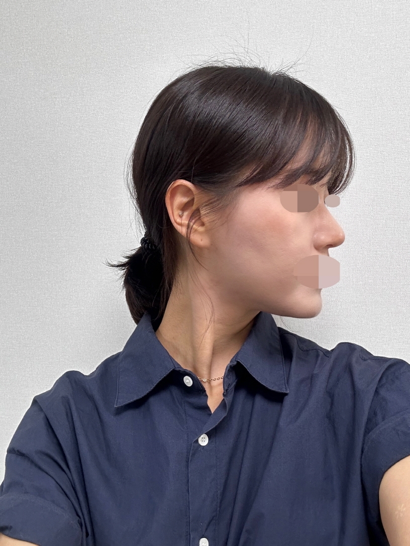 수술후기이미지