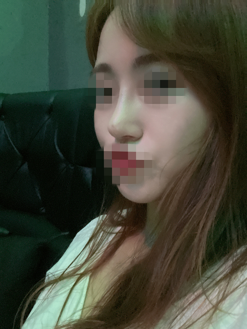 수술후기이미지