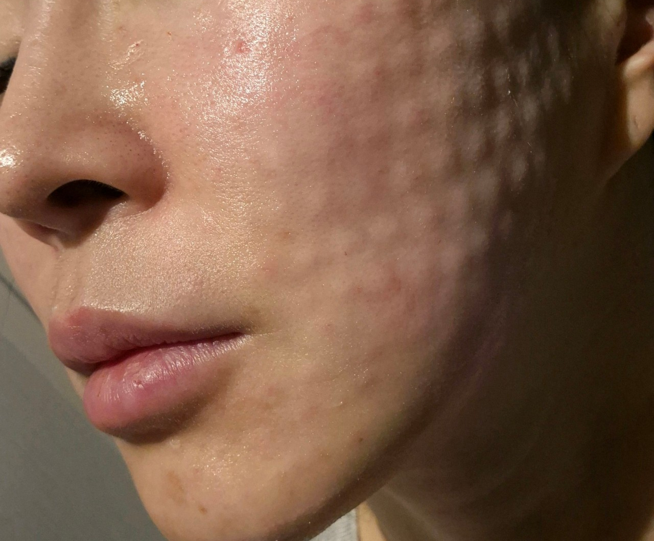 수술후기이미지