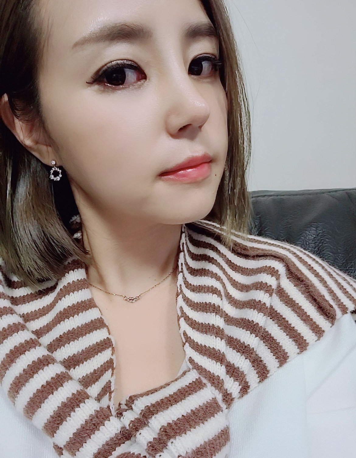 수술후기이미지