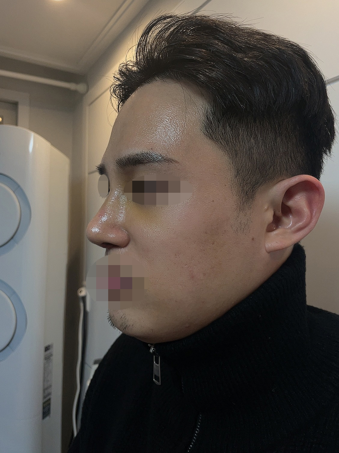 수술후기이미지