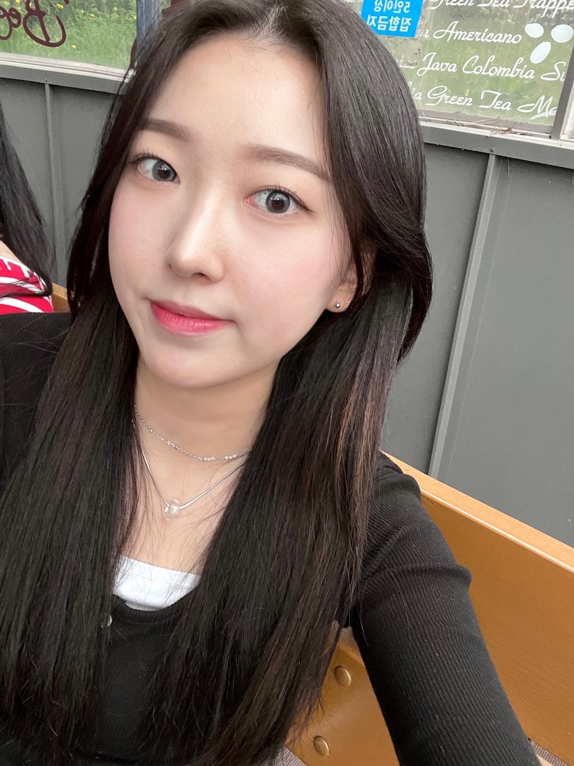 수술후기이미지