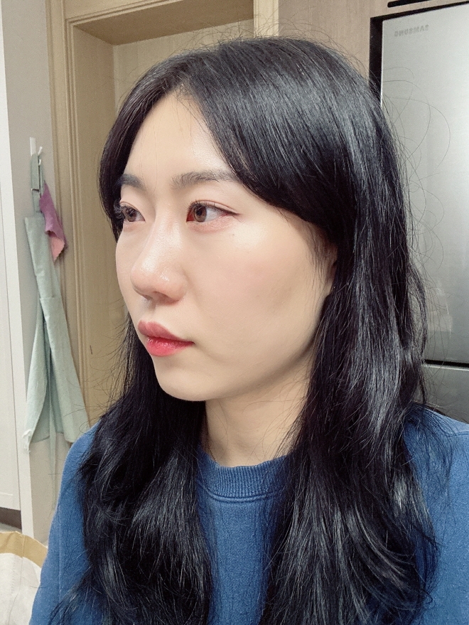 수술후기이미지