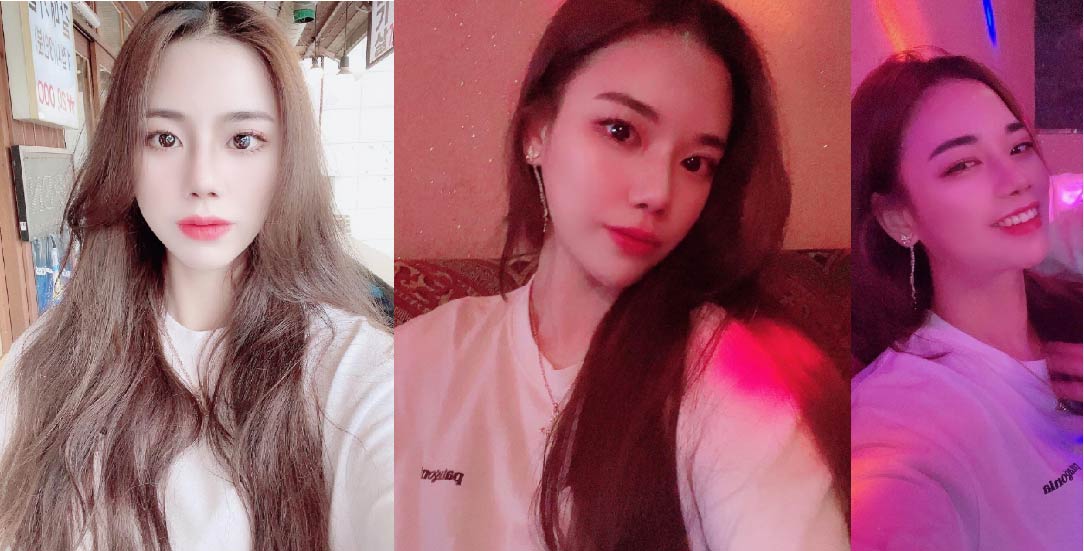 수술후기이미지