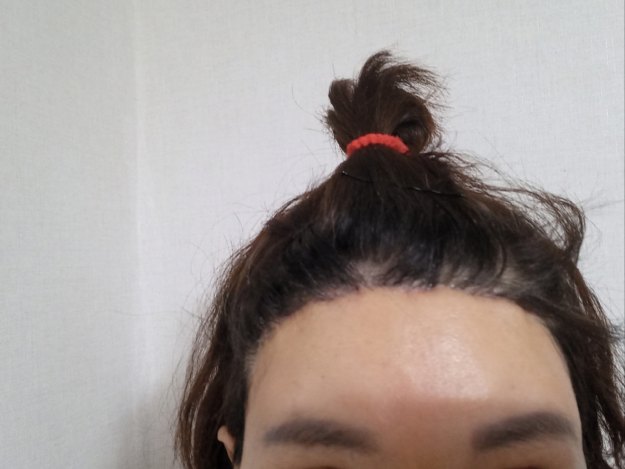 수술후기이미지