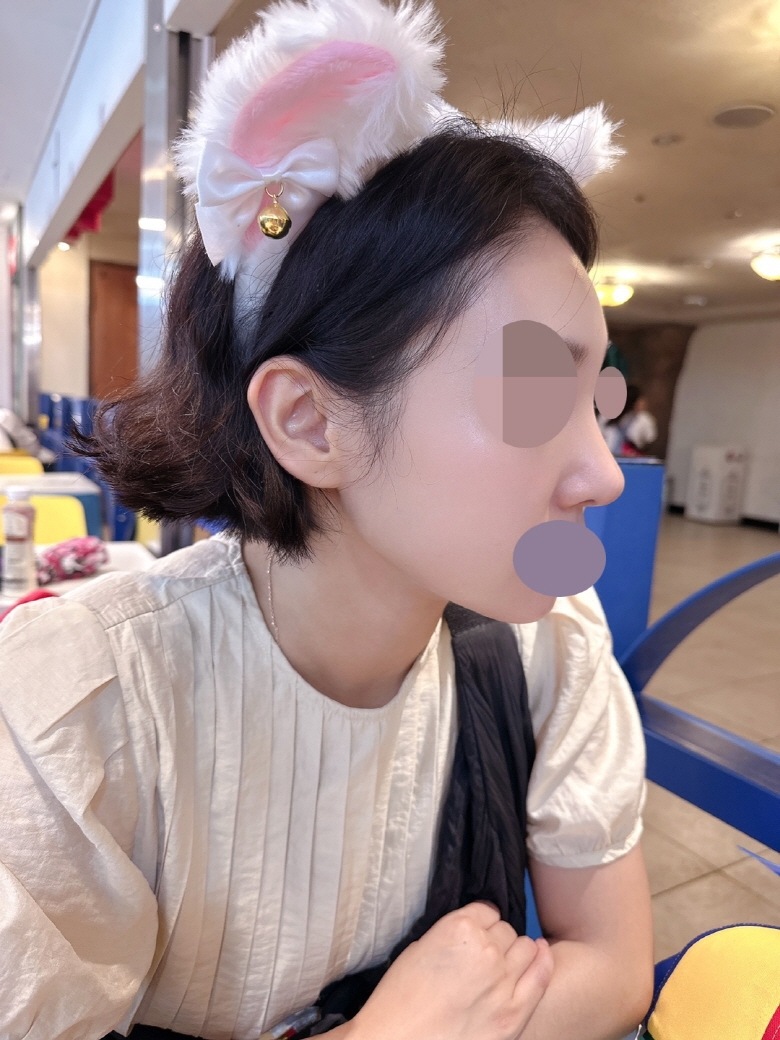 수술후기이미지