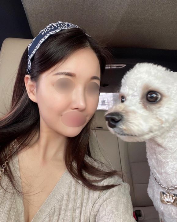 수술후기이미지