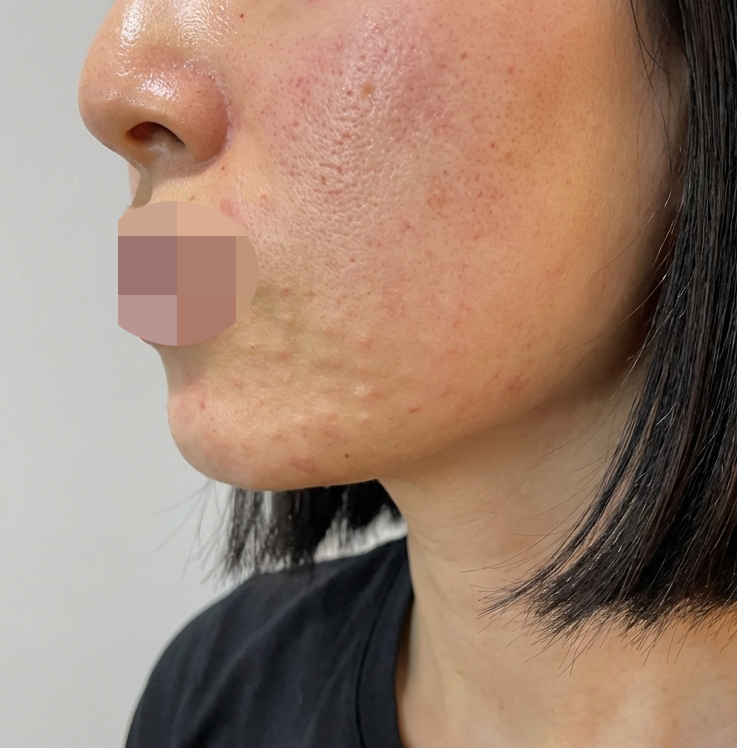 수술후기이미지