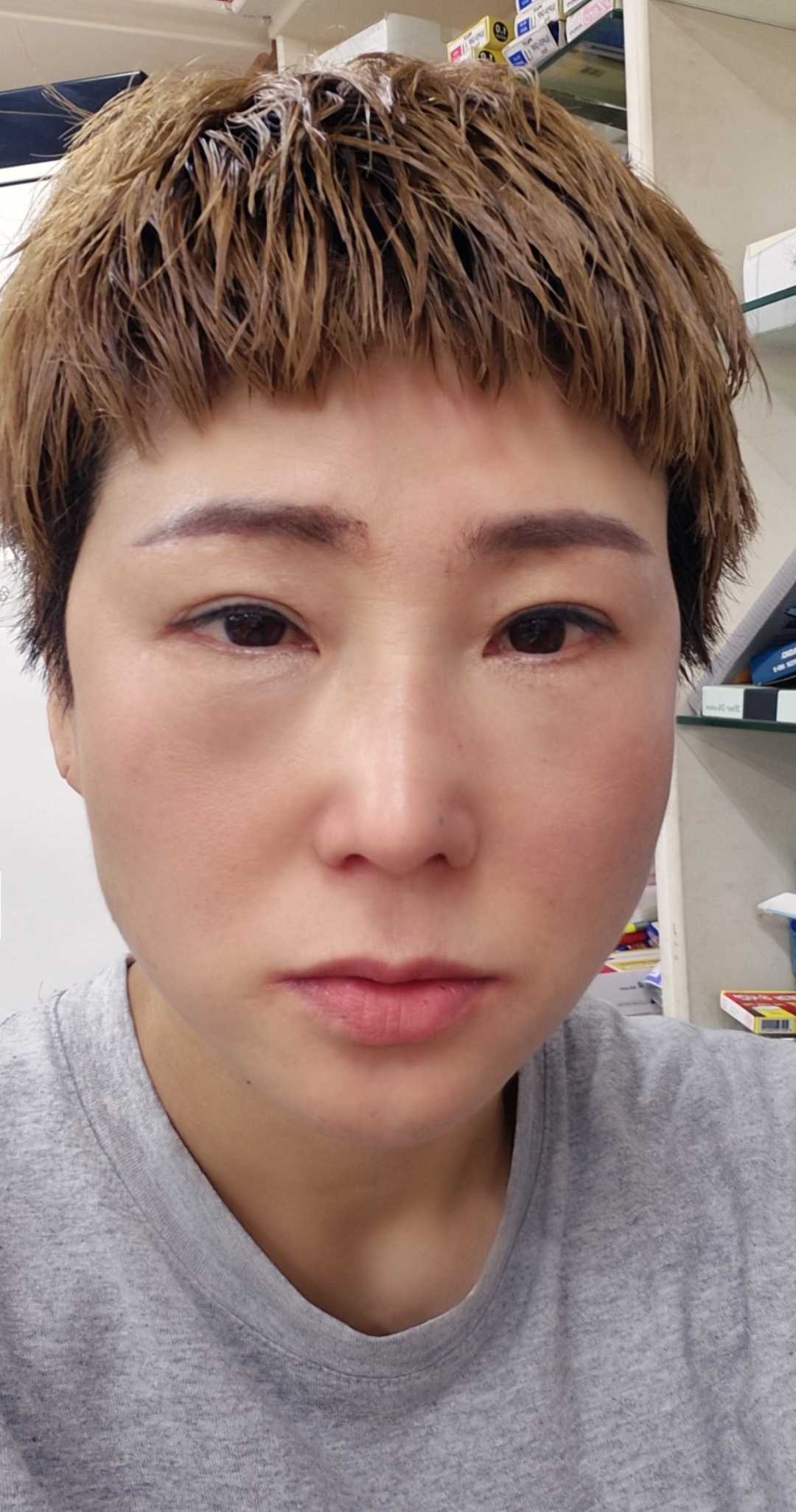 수술후기이미지