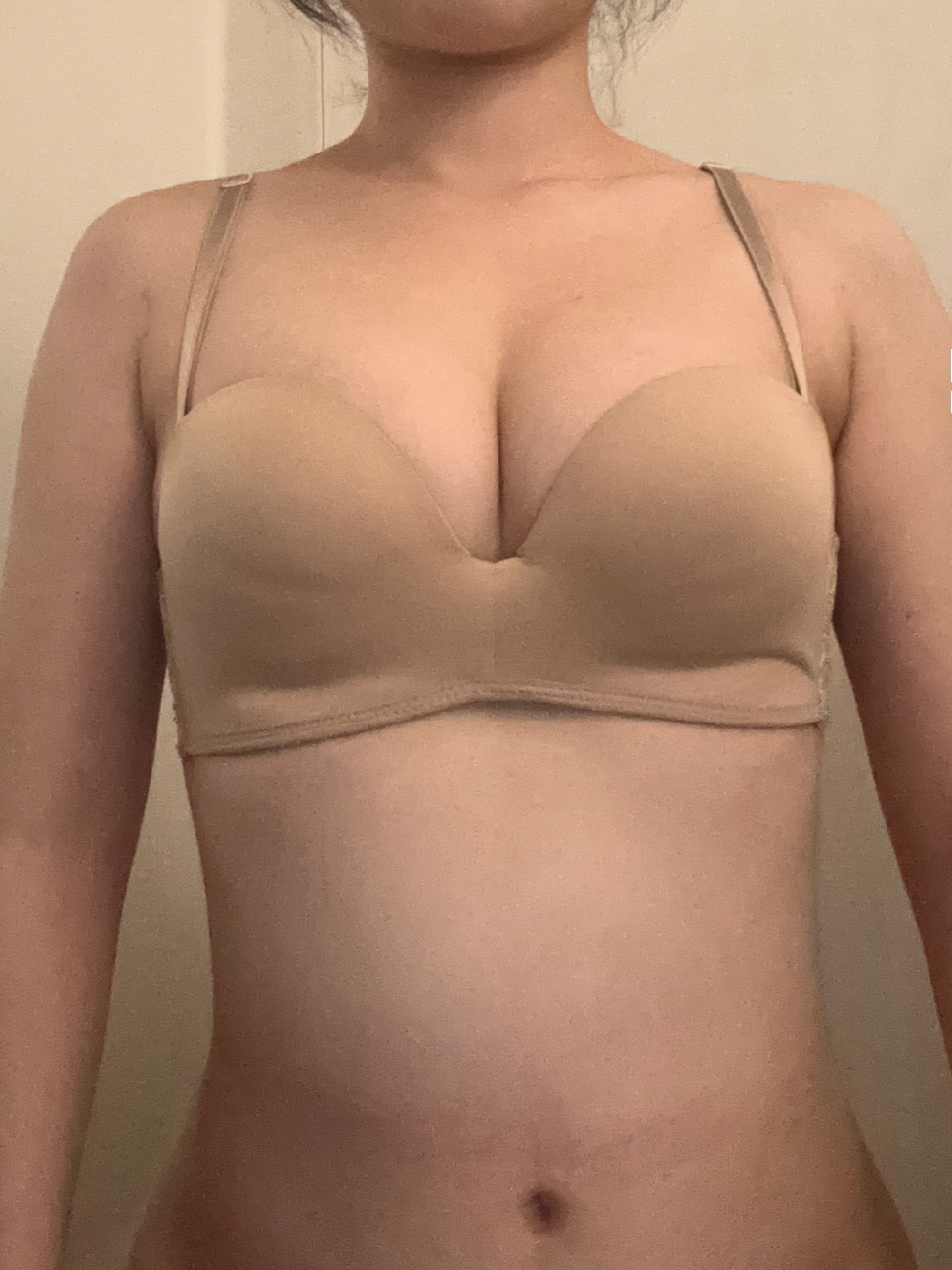 수술후기이미지