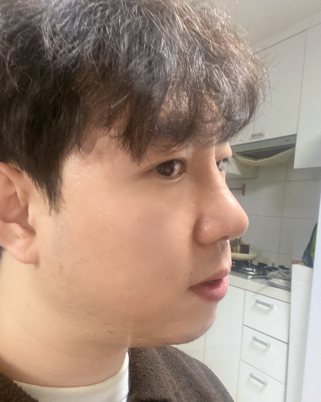 수술후기이미지