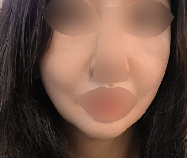 수술후기이미지