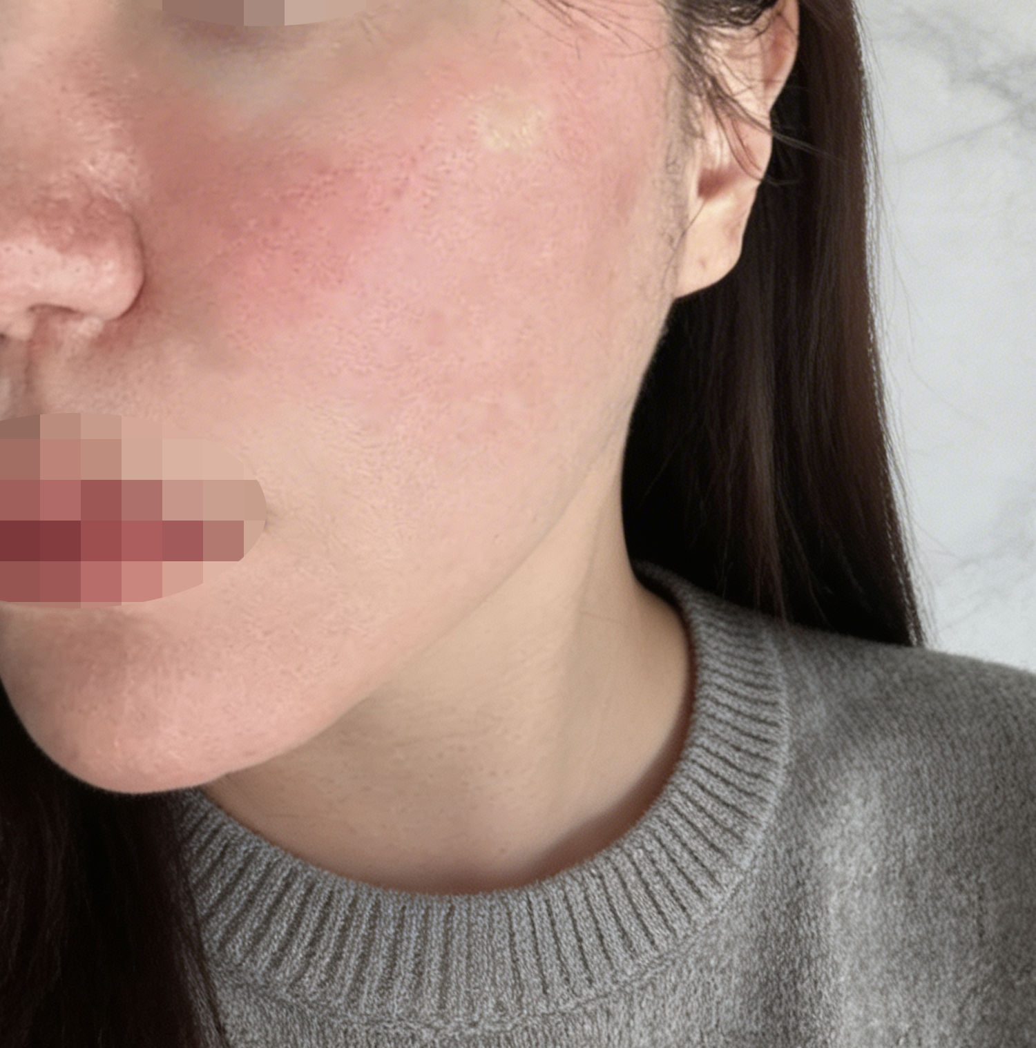 수술후기이미지