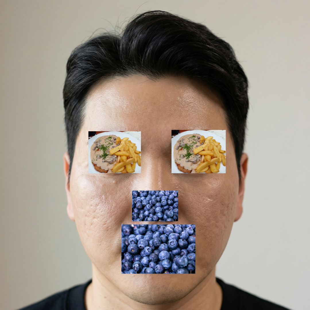 수술후기이미지