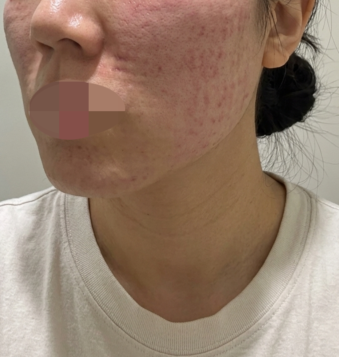 수술후기이미지