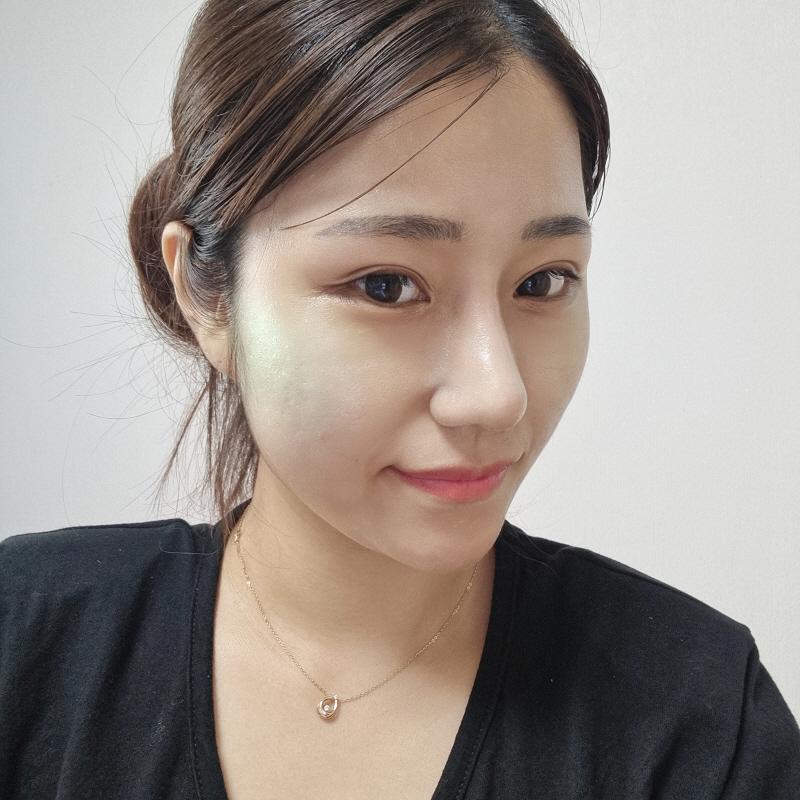 수술후기이미지