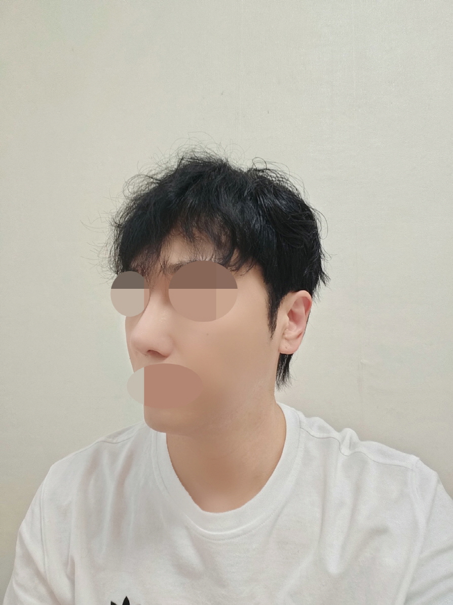 수술후기이미지